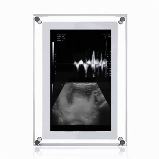 SnapCadre™ Cadre numérique